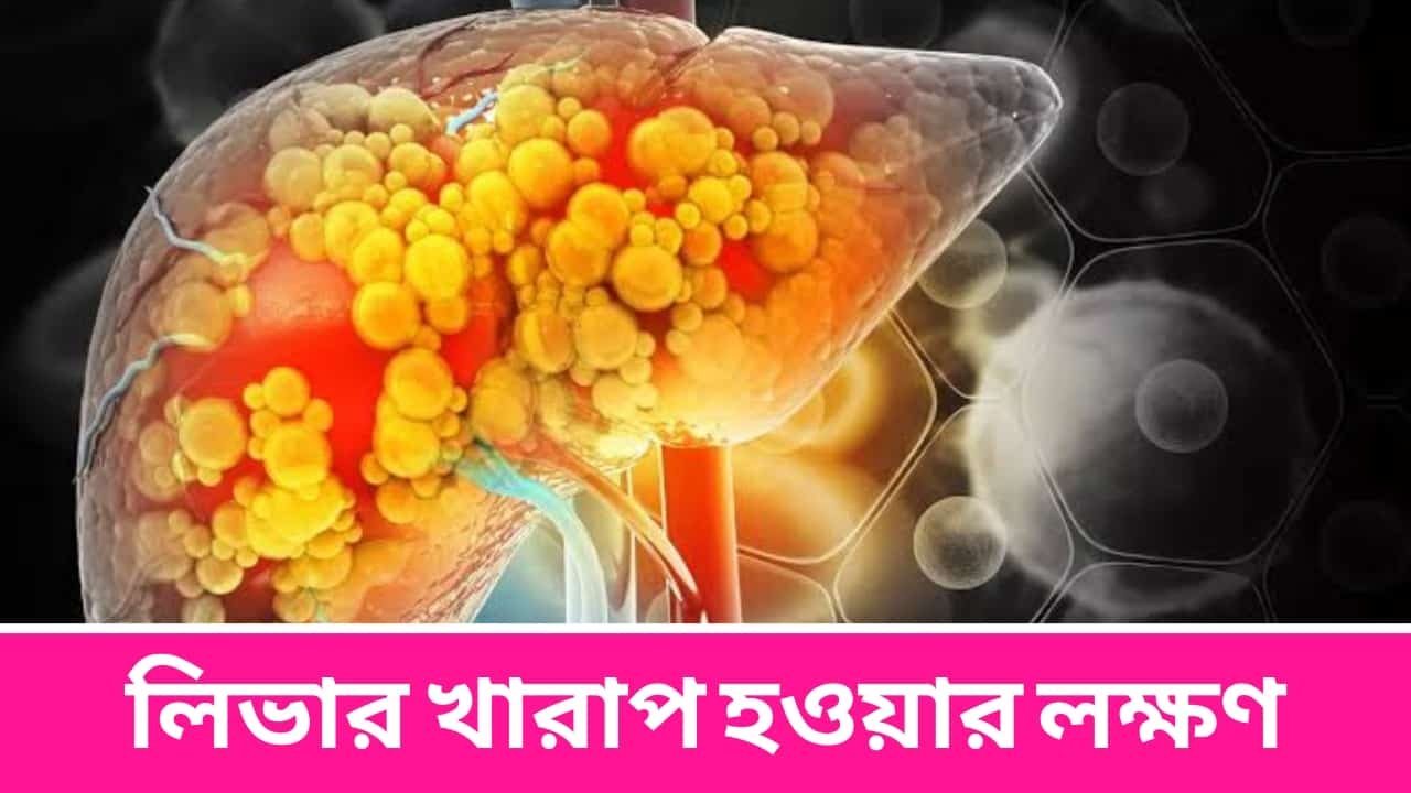 লিভার খারাপ হওয়ার লক্ষণ